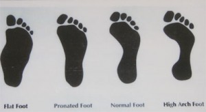 Foot Problems - Premier Orthotics Lab